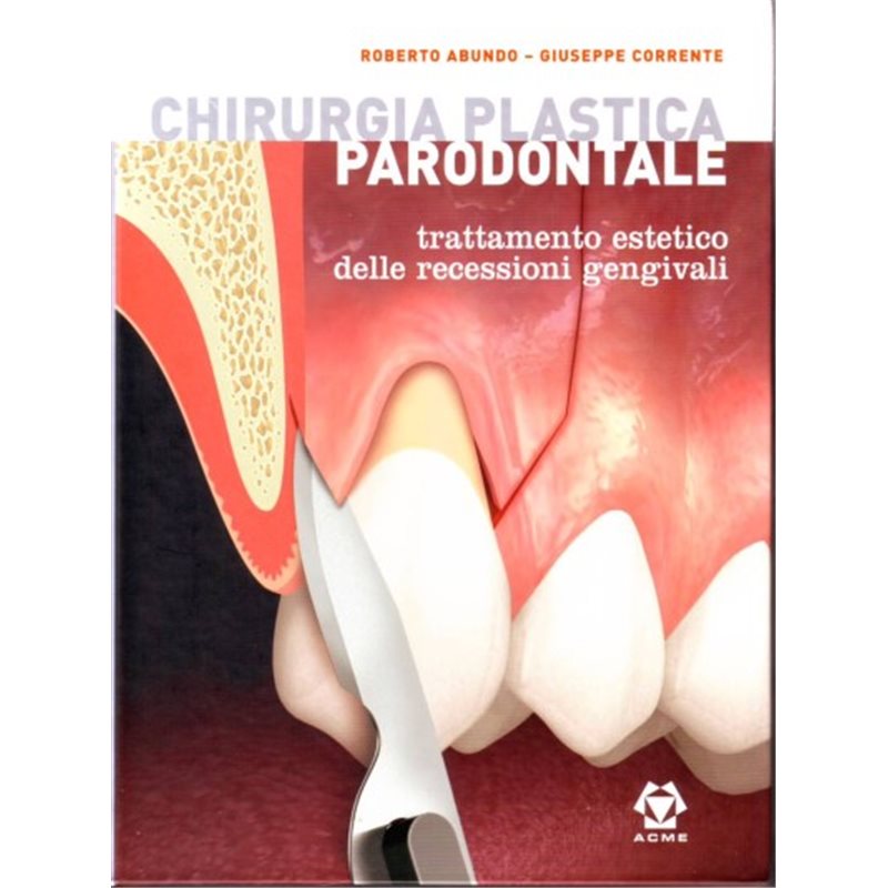 Chirurgia plastica parodontale - Trattamento estetico delle recessioni gengivali